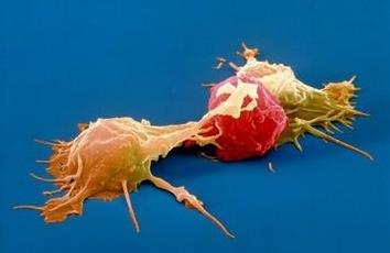 工程化自然杀伤细胞NK可能是下一个伟大的癌症免疫疗法