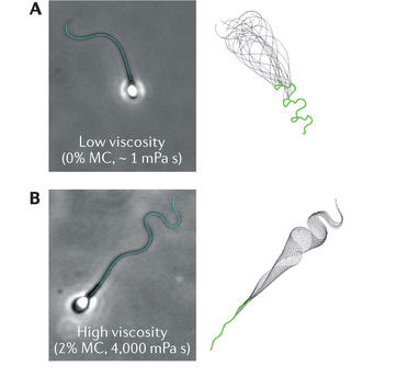 应用微流控技术治疗男性不育症的原理:调节精子的运动