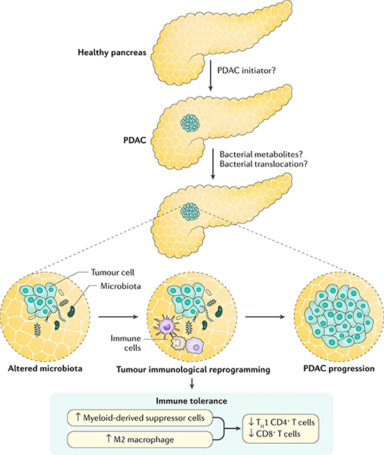 胰腺健康问题与微生物群的关系